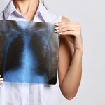 Redakan Gejala Bronkitis Dengan 5 Pengobatan Alami Ini